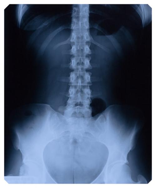 Xray record of the spinal cord